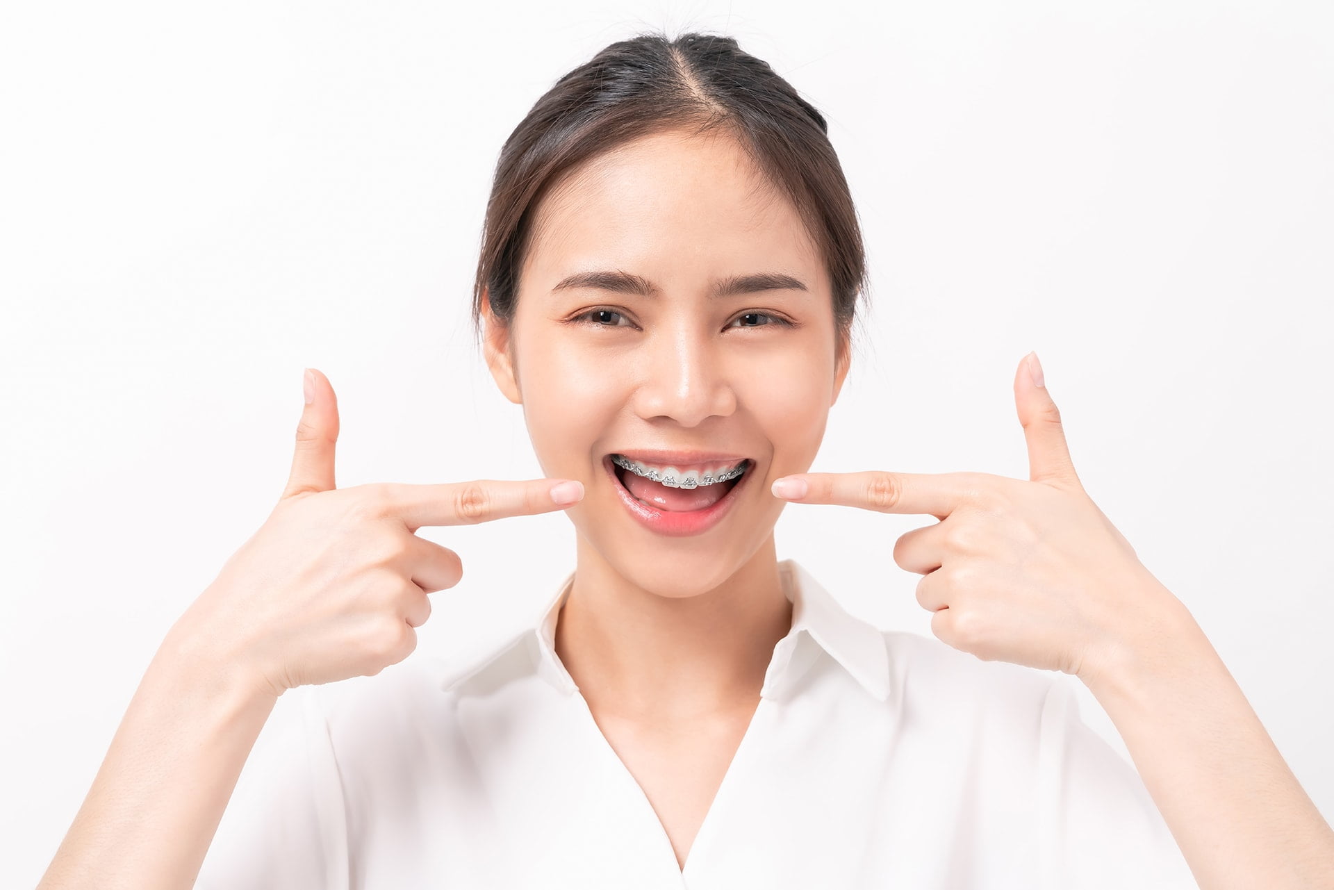 What should oral hygiene look like while wearing braces?
