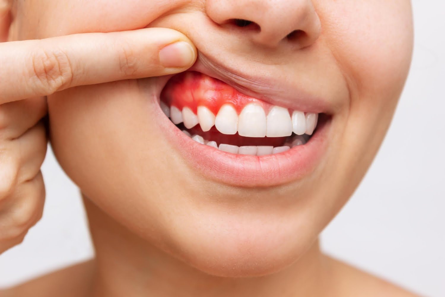 Odontoma – what is this jaw tumor and what should you know about it?