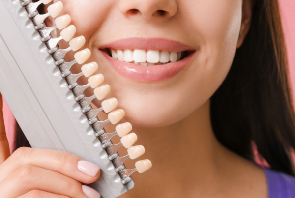 Licówki kompozytowe na zęby – zalety i wady licówek, ile kosztują licówki na zęby, czy warto zdecydować się na założenie licówek kompozytowych?